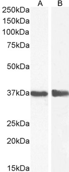 GAPDH (C Terminus) Loading Control Antibody