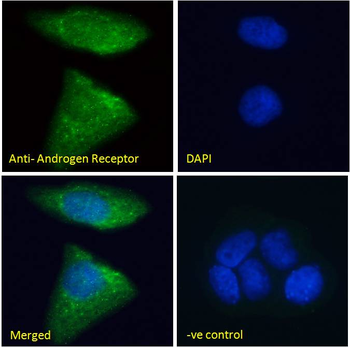 Androgen Receptor Antibody
