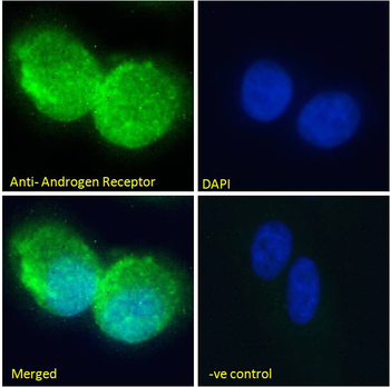 Androgen Receptor Antibody