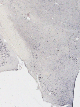 Androgen Receptor Antibody