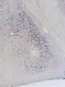 Androgen Receptor Antibody