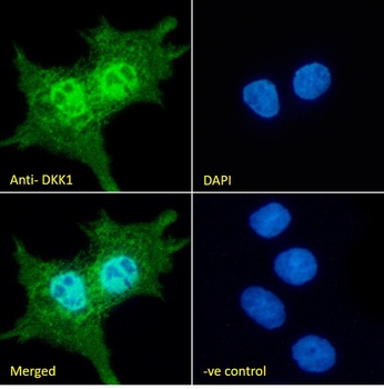 DKK1 Antibody
