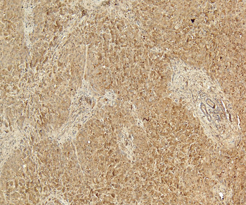58KGolgi protein(Internal)/FTCD Antibody