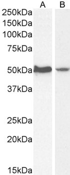AKT3 Antibody