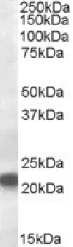 VPS25 Antibody