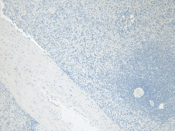 AIF1/IBA1 (isoform 3) Antibody