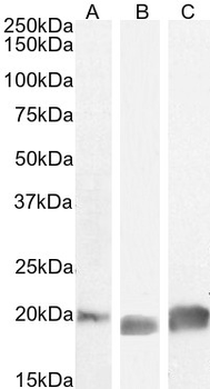 GPX4 (Isoform a and c) Antibody
