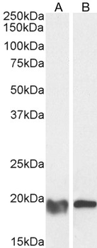 GPX4 (Isoform a and c) Antibody
