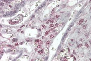 XRCC4-like factor/NHEJ1 Antibody