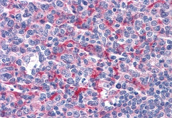 GABPB2 Antibody