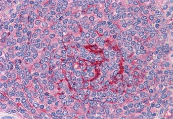 GABPB2 Antibody
