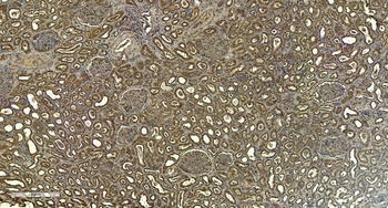 Goat anti-FCER1A (aa177-189) Antibody