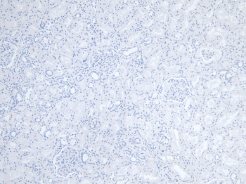 Goat anti-FCER1A (aa177-189) Antibody