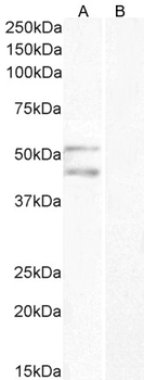 TOM1L1/SRCASM Antibody