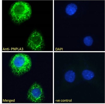 Pnpla3/Adiponutrin (mouse) Antibody