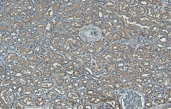 Pnpla3/Adiponutrin (mouse) Antibody