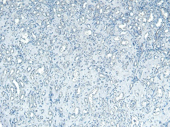 Pnpla3/Adiponutrin (mouse) Antibody