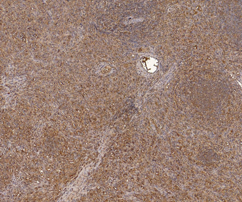 Goat Anti-AIF1/IBA1 isoform 1 and 3 (Human reactivity only) Antibody