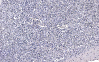 Goat Anti-AIF1/IBA1 isoform 1 and 3 (Human reactivity only) Antibody