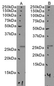 APOA1BP Antibody