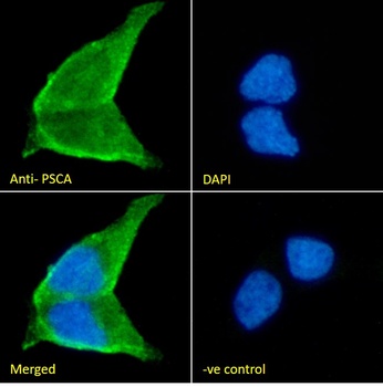 PSCA (aa27-40) Antibody