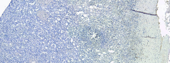 Goat anti-S100A9 Antibody