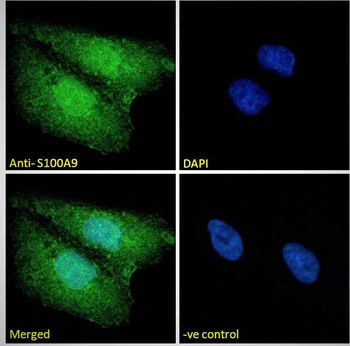 Goat anti-S100A9 Antibody