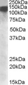DHX9/RHA Antibody