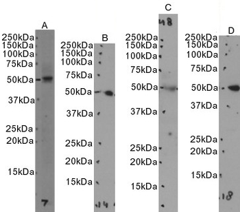 SEPT6 Goat Polyclonal Antibody