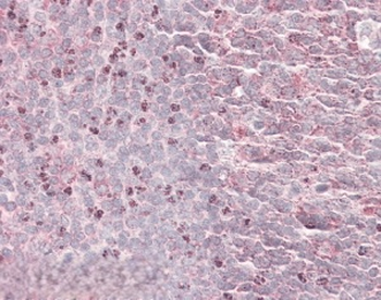 SEPT6 Goat Polyclonal Antibody