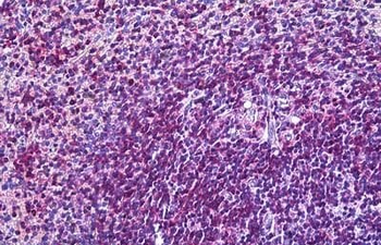 Goat anti-CD11A / integrin alpha L Antibody