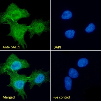 SALL1 (aa29-43) Antibody