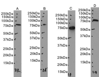 NDUFS1 Antibody