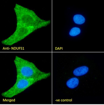 NDUFS1 Antibody