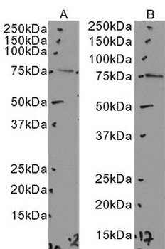 NDUFS1 Antibody