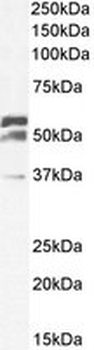 Positive Control Lysate for anti- TOM1L1 antibody