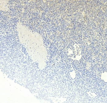 Goat RANTES Antibody