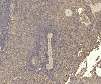 Goat RANTES Antibody