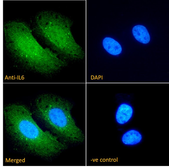Goat IL-6 (aa138-148) Antibody