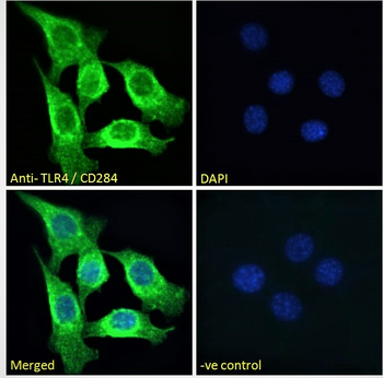 TLR4/CD284 Antibody