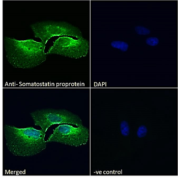 Somatostatin proprotein (aa58-70) Antibody