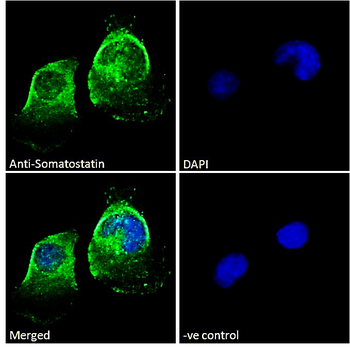 Somatostatin proprotein (aa58-70) Antibody