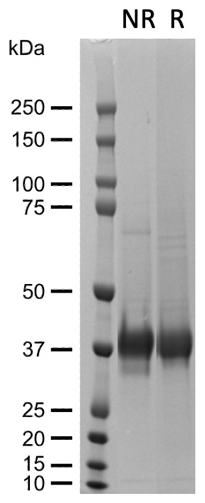 AVS Bio - hRSPO1-his