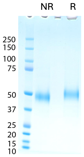 AVS Bio - Upar-(His)N, Human, Recombinant