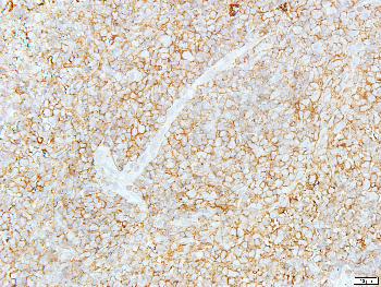 Goat Anti-Rabbit IgG (H+L) Antibody (HRP)
