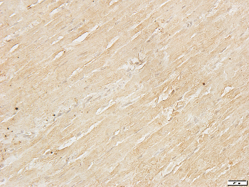 ACTN2 Rabbit Polyclonal Antibody