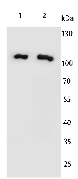 ACTN2 Rabbit Polyclonal Antibody