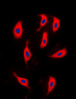 ACTN2 Rabbit Polyclonal Antibody