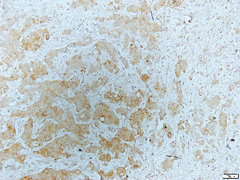 CD95 Rabbit Polyclonal Antibody