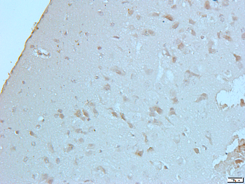 CD178 Rabbit Polyclonal Antibody